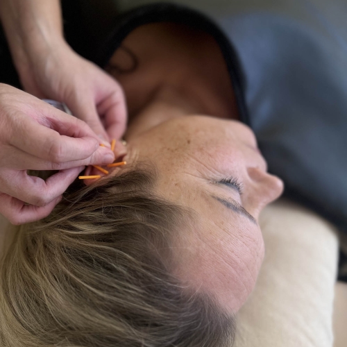 Øreakupunkturbehandling hos akupunktør i Odense nær Tarup og Stige