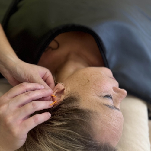 Øreakupunktur behandling hos akupunktør i Odense nær Kerteminde og Næsby