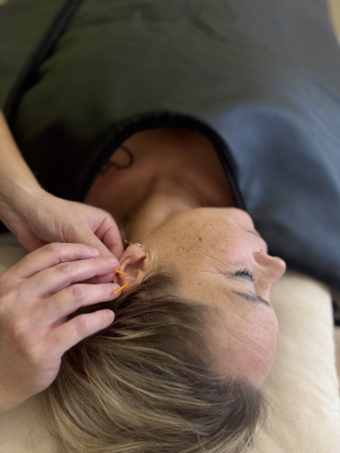 Øreakupunktur behandling hos akupunktør i Odense nær Kerteminde og Næsby